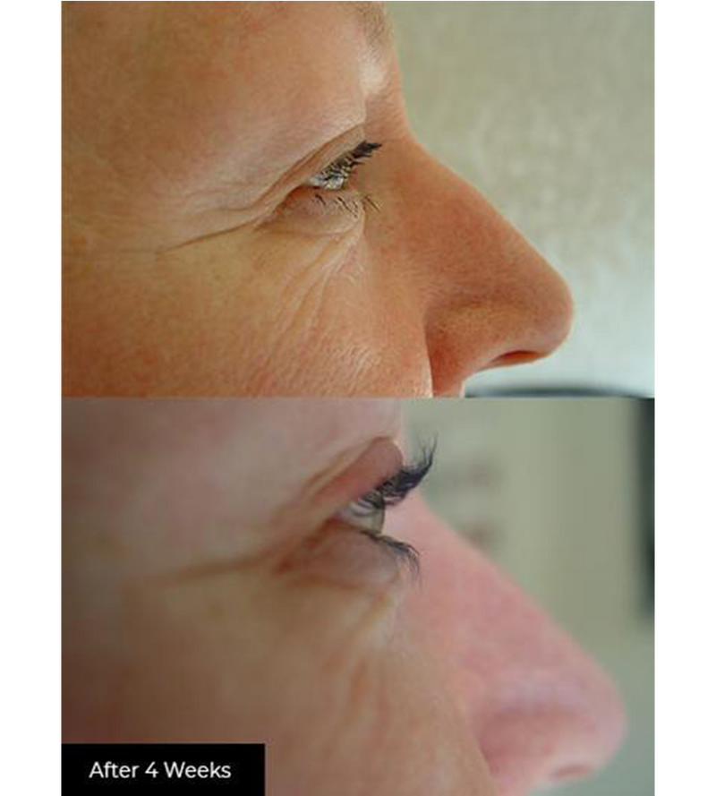 Avante Dynamic Lash Serum 2ml