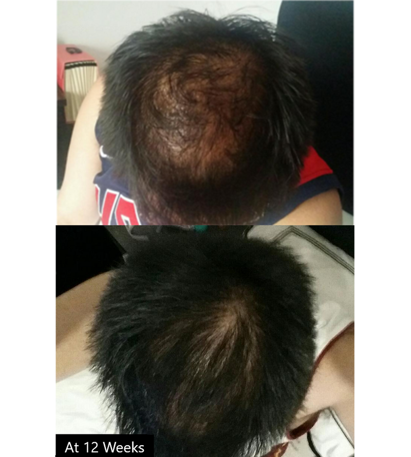 Avante Hair Restoration Serum 50ml