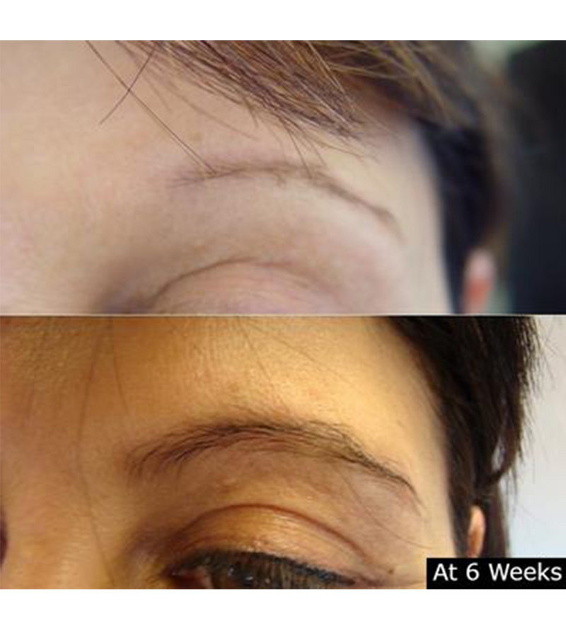 Avante Dynamic Brow Serum 4ml