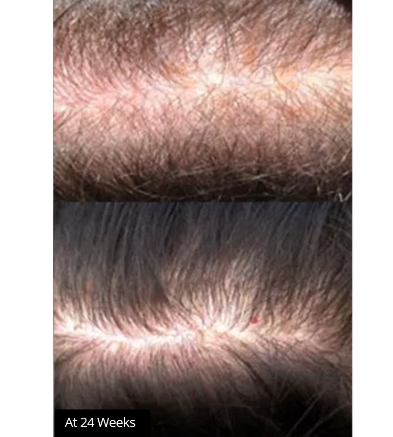 Avante Hair Restoration Serum 50ml